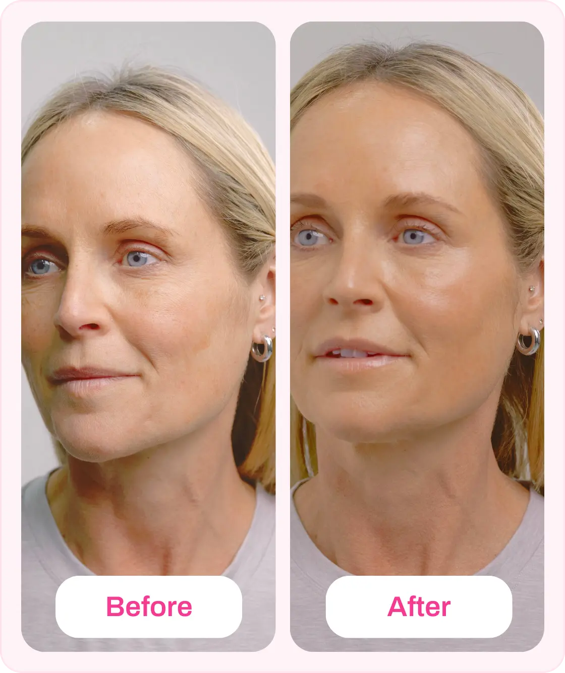 TV OFFER SALMYN DNA Treatment Kit K Republiq
