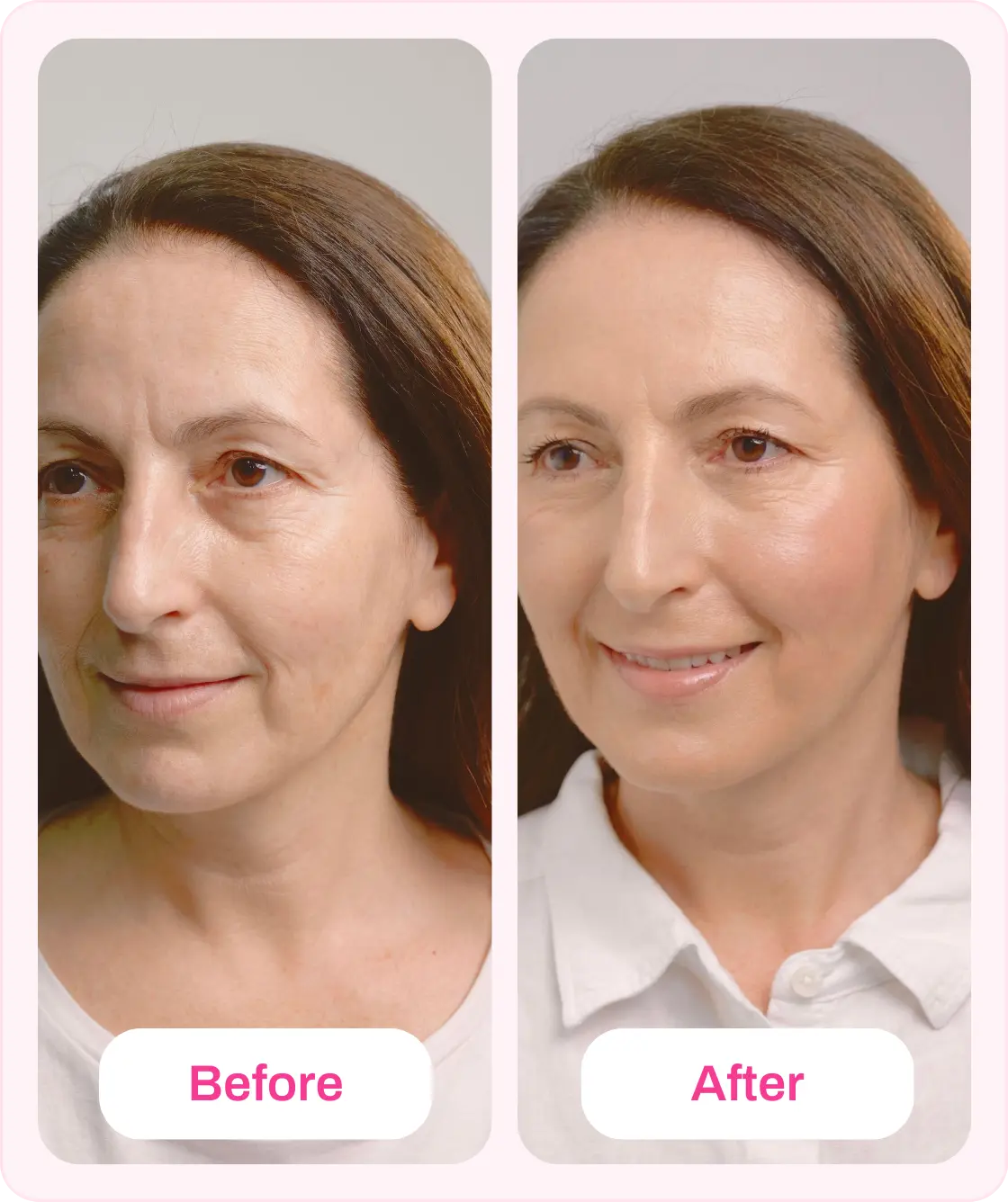 TV OFFER SALMYN DNA Treatment Kit K Republiq