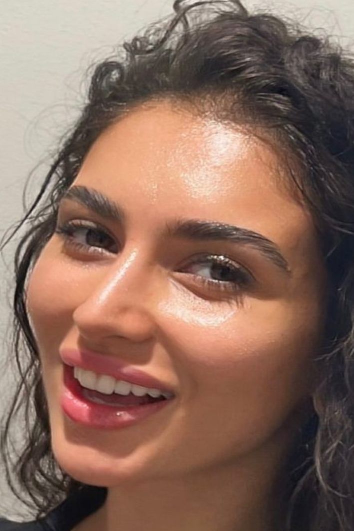Close-up of a smiling woman with healthy, glowing skin