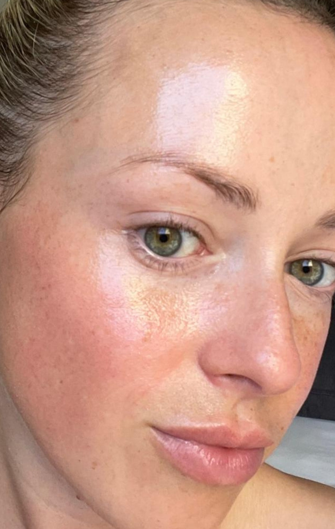 A close-up shot of a woman's face showing visible results showing reduced blemishes and glow with K Republiq skincare