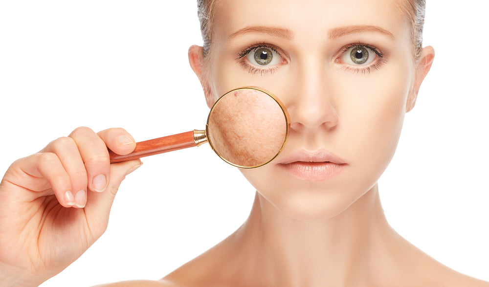 Woman holding a magnifying glass over her cheek, highlighting dark spots and uneven skin tone, representing K Republiq’s multi-targeted serum that brightens, renews, and prevents pigmentation for a clear, glowing complexion.